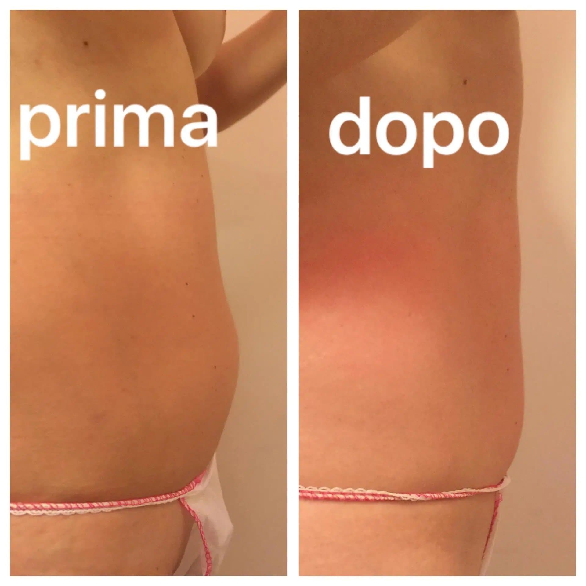 Prima e dopo 4